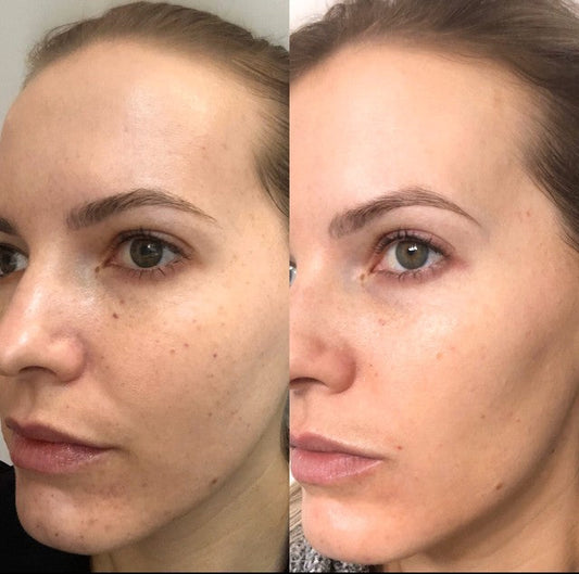 Skin Revolumizer Beauty Booster (Face) - 3 Pack