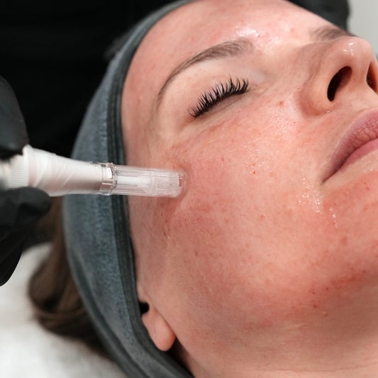 Microneedling - 3 Pack