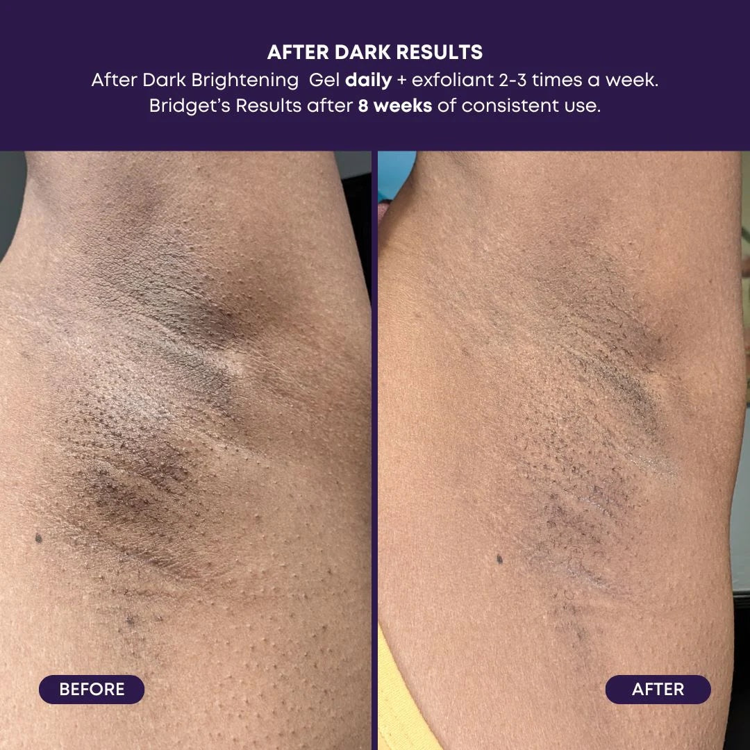 Bushbalm Brightening Gel - After Dark