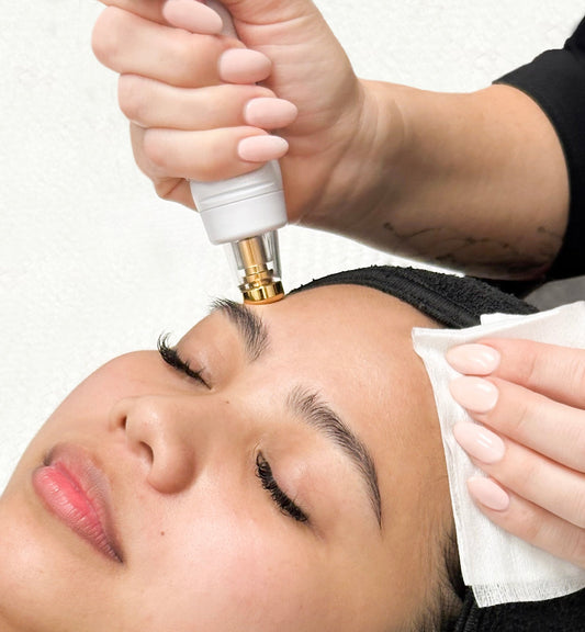 RF TempSure Skin Tightening - Single (Full Face)