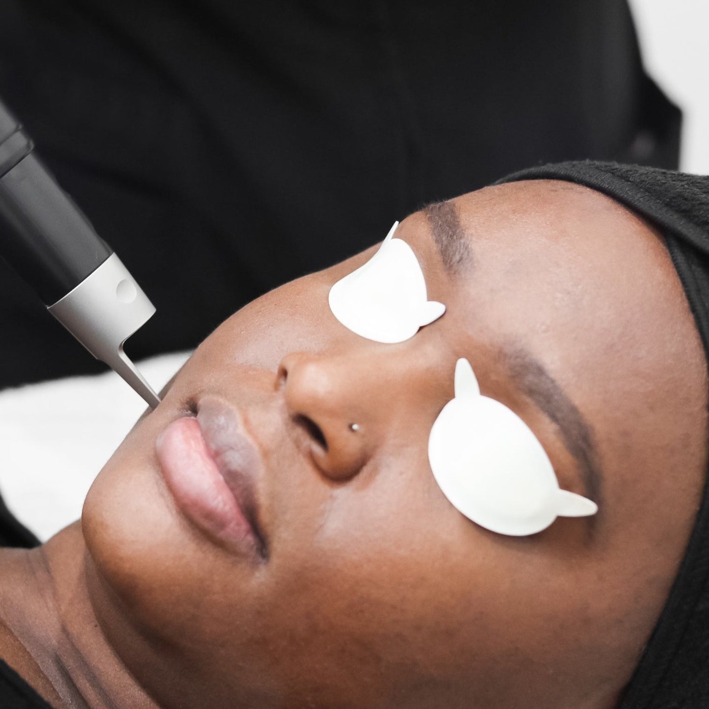 PicoSure Laser Skin Rejuvenation - Single (Face)