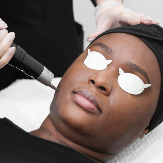 PicoSure Laser Skin Rejuvenation (Full Face) - 3 Pack
