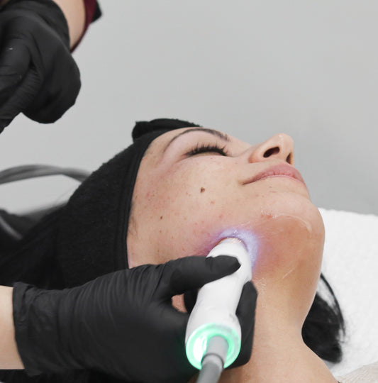 RF TempSure Skin Tightening  - 3 Pack (Full Face)