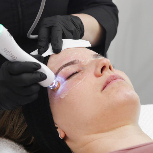 RF TempSure Skin Tightening - 3 Pack (Eyes)