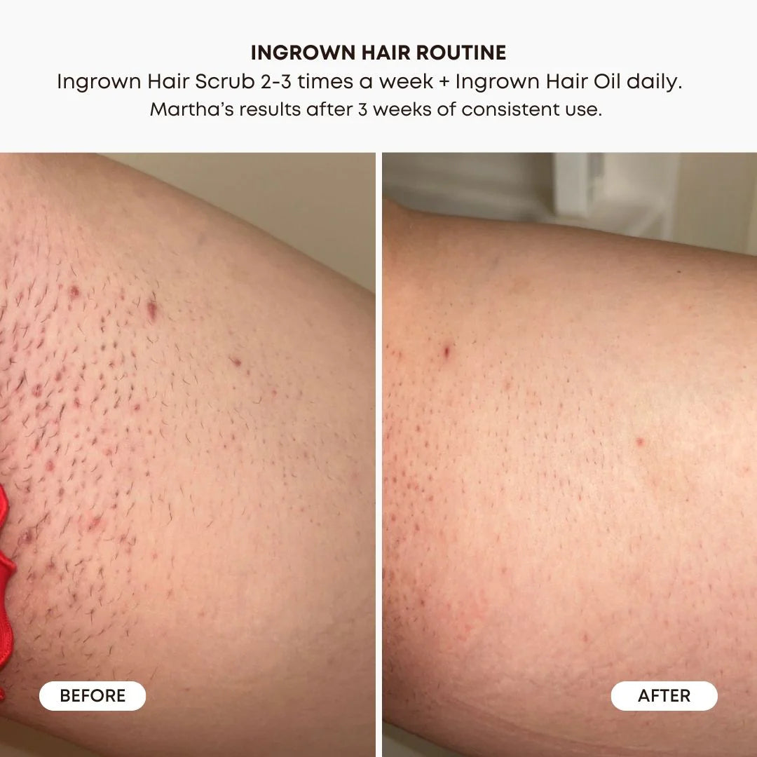 Bushbalm Ingrown Hair Exfoliating Scrub - Nude
