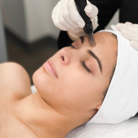 Mesotherapy - Meso Acne