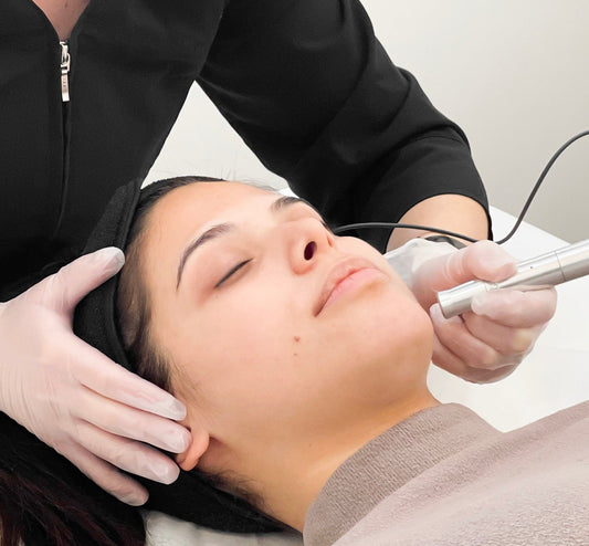 Microneedling - Single