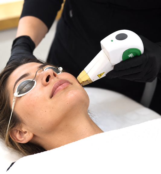 IPL Photofacial - 3 Pack